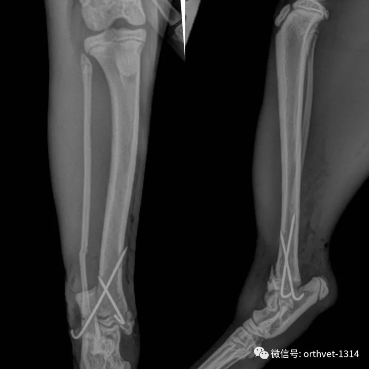 犬の橈尺骨骨折の手術（整形外科） | やまと動物病院