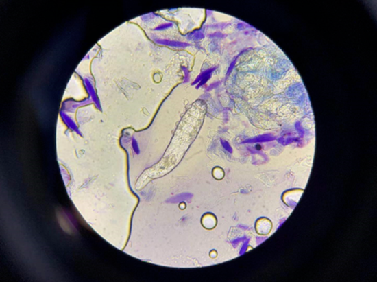 40倍显微镜下螨虫图片图片